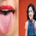 Tongue Color and health