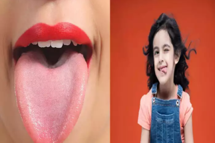 Tongue Color and health