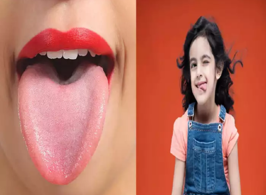 Tongue Color and health